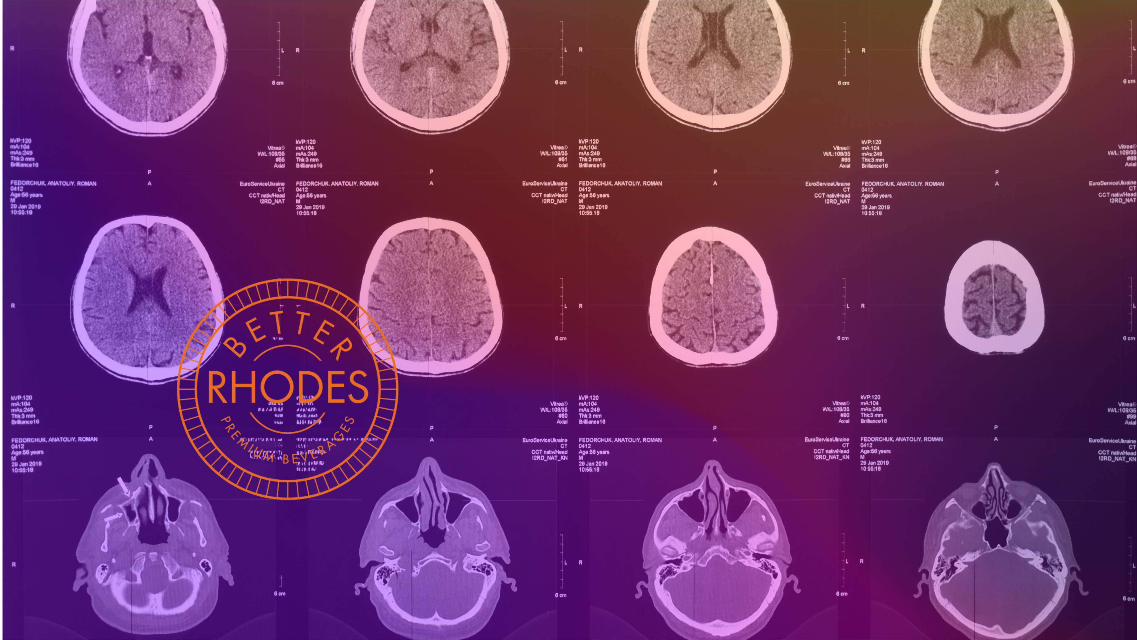 What Happens to Your Brain When You Stop (or Cut Back on) Drinking